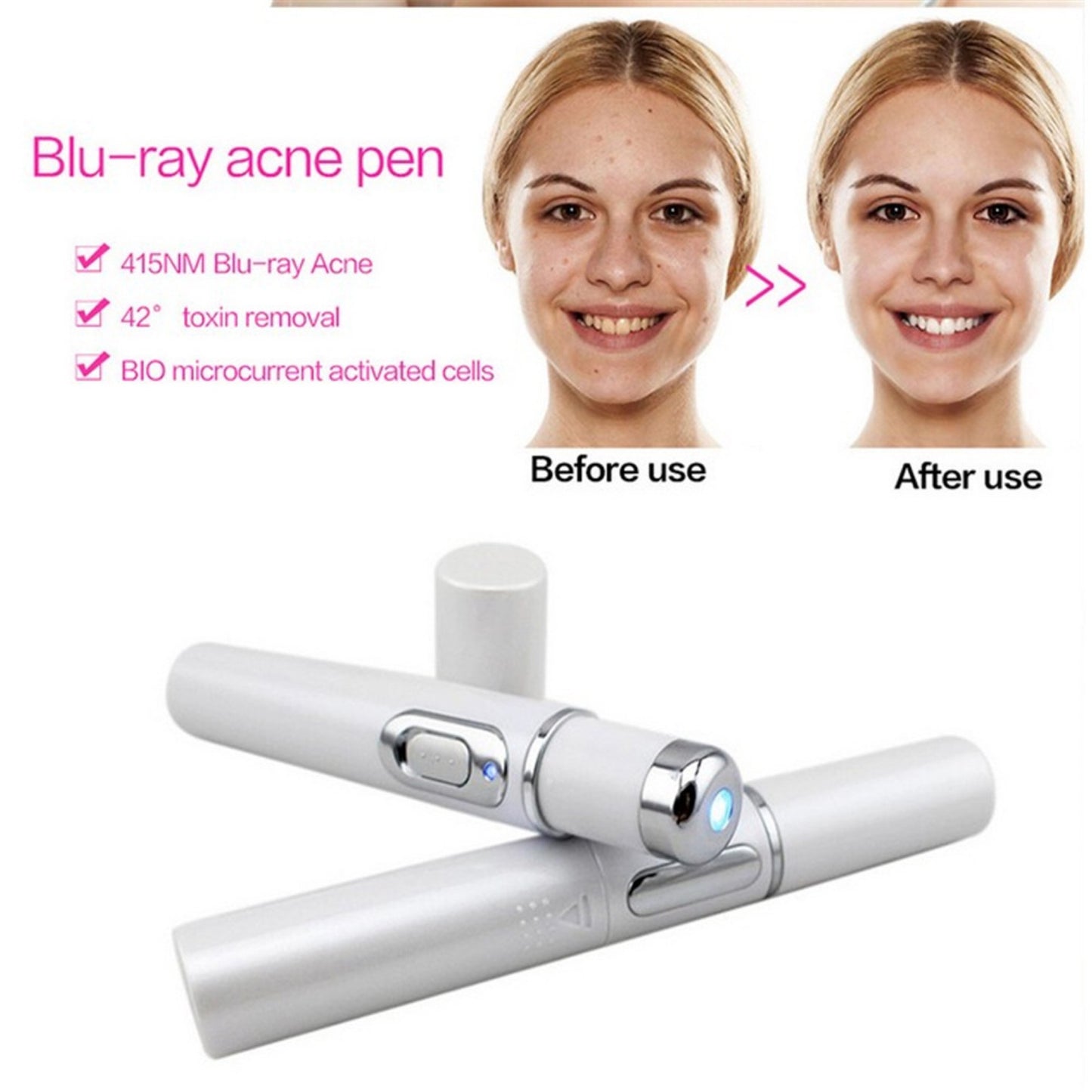 BuzzNest Blue Light Therapy Acne Pen | Scar & Wrinkle Removal Device