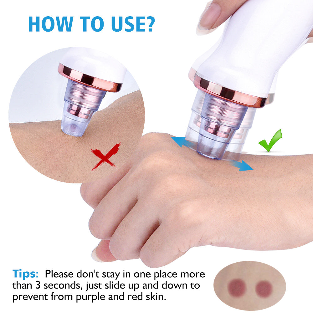 BuzzNest Electric Blackhead Remover | Deep Pore Suction & Skin Rejuvenation