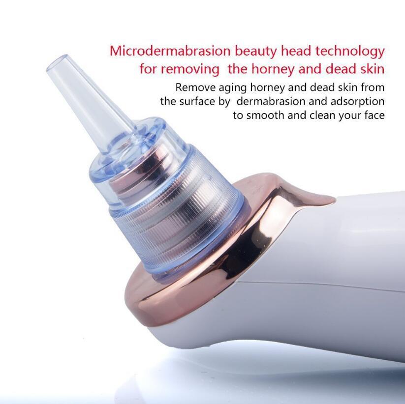 BuzzNest Electric Blackhead Remover | Deep Pore Suction & Skin Rejuvenation