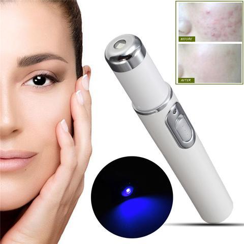 BuzzNest Blue Light Therapy Acne Pen | Scar & Wrinkle Removal Device