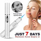 BuzzNest Blue Light Therapy Acne Pen | Scar & Wrinkle Removal Device